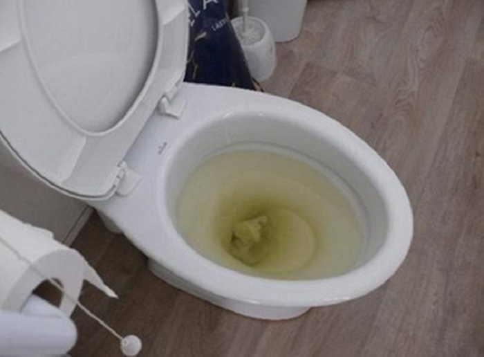 Tắc bồn cầu gây ra nhiều tác hại rất nghiệm trọng, đặc biệt là làm xáo trộn cộng sống sinh hoạt của gia đình bạn